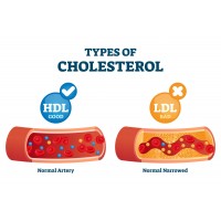Tratament naturist Colesterol si Trigliceride